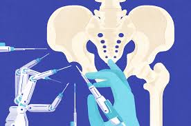 Robotic hip surgery Nagpur