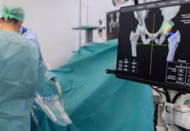 Robotic hip surgery Nagpur