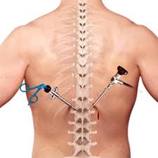 Spine Surgery Nagpur